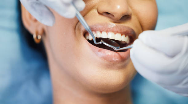 Best Pediatric Emergency Dentist in Fort Loramie, OH